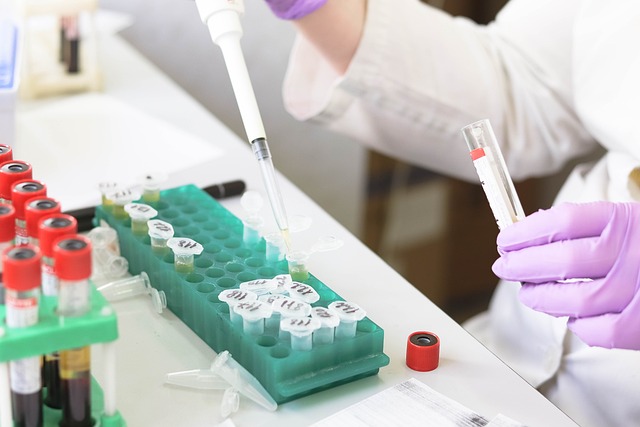 Makroglobulinemia Waldenströma – co to jest, objawy, diagnostyka