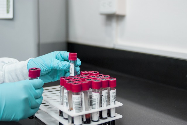 Ostra białaczka szpikowa – co to jest, objawy, diagnostyka, leczenie